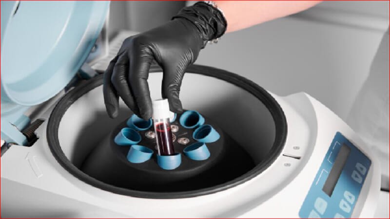 The Essential Role of Precision Metal Tubing in Advancing Modern Medical Devices